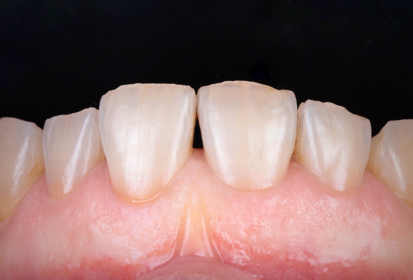 6S3A7508
